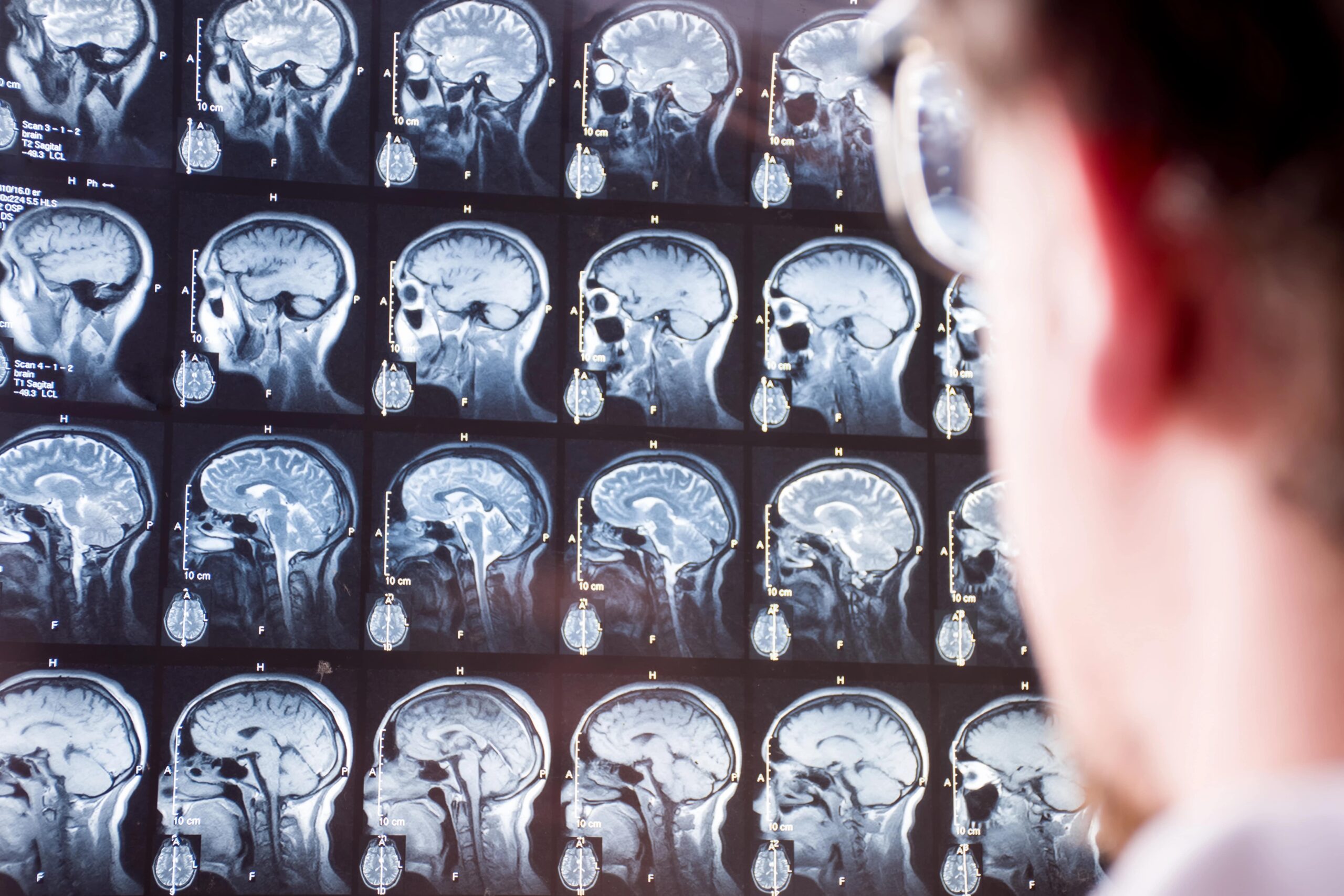 Doctor viewing MRI scan of head and brain